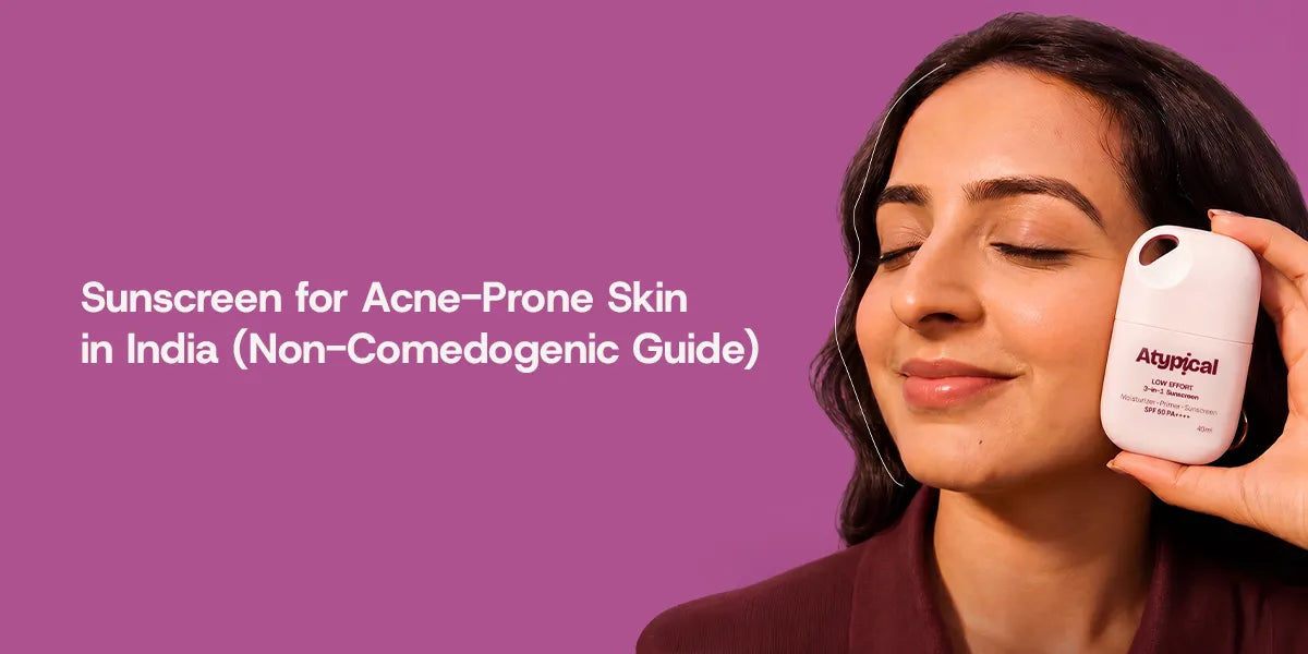 Sunscreen for Acne-Prone Skin India: Non-Comedogenic SPF 50